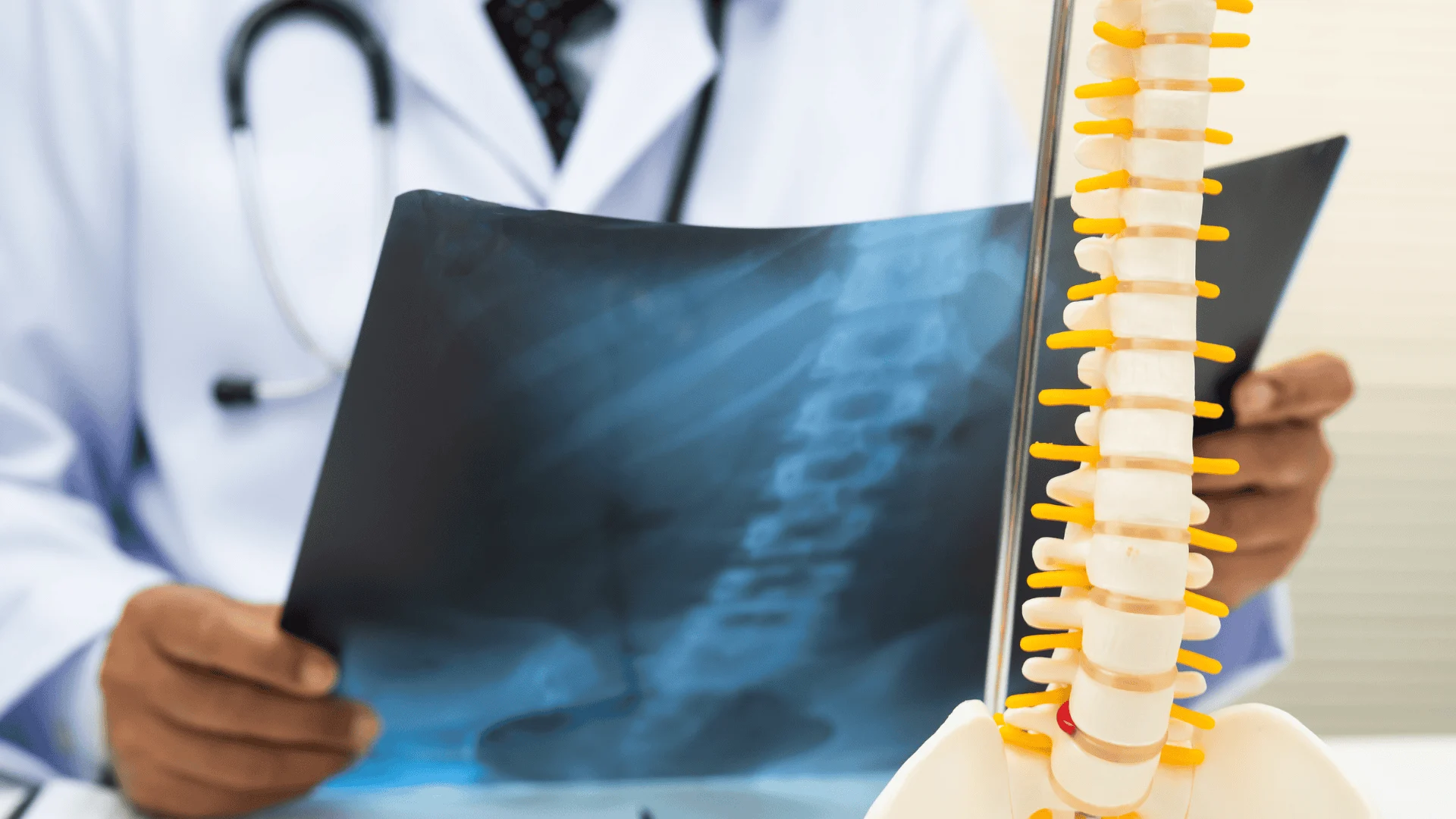 Cervical spondylosis in Sandhigata Vata: degenerative cervical spine disorder and therapeutic role of Agnikarma